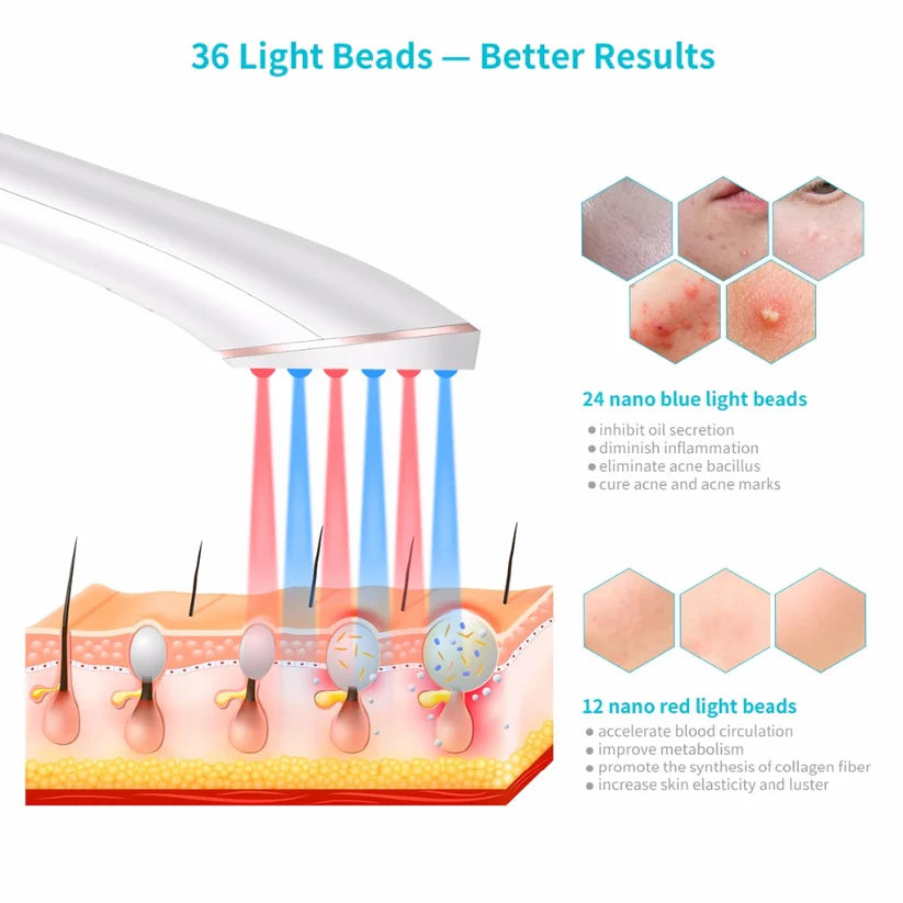 Xpreen Rechargeable Acne Light Therapy Device